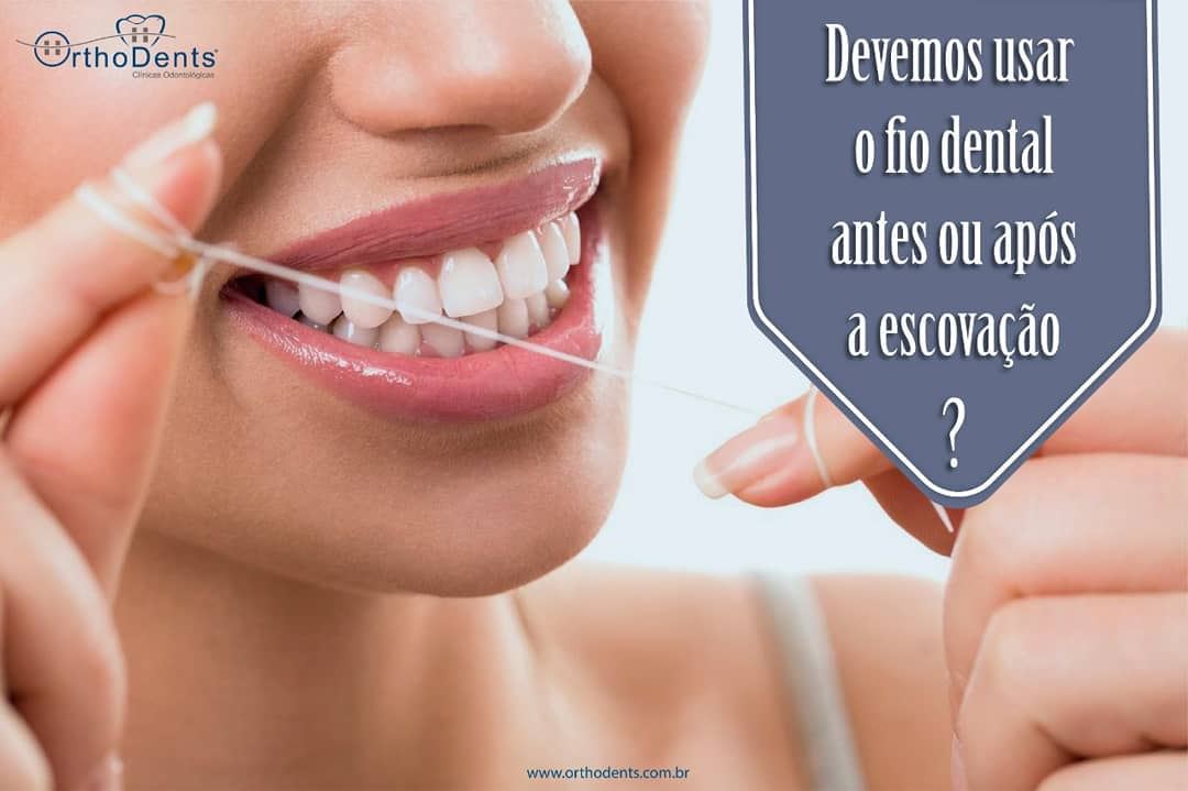 Fio Dental Antes Ou Depois De Escovar