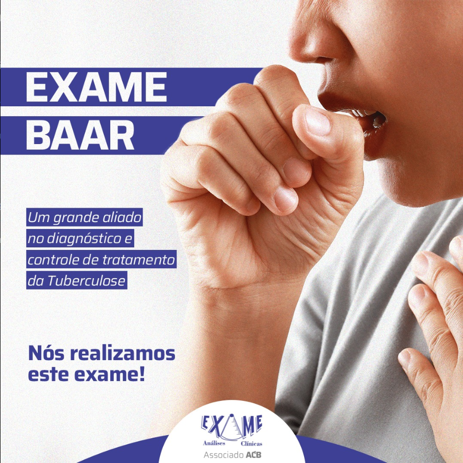 Exame Análises Clínicas