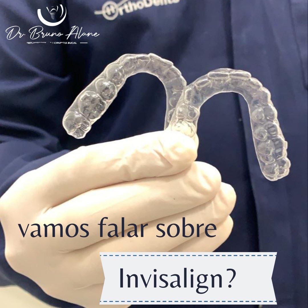 O desenvolvimento das moldeiras do Invisalign é um processo que envolve uma tecnologia muito avançada na área da ortodontia, de forma a oferecer mais previsibilidade e controle em relação aos resultados do tratamento – além de uma maior velocidade. Após a avaliação o ortodontista utiliza o software ClinCheck, também desenvolvido exclusivamente para este sistema, para fazer o mapeamento das movimentações necessárias para que você tenha um sorriso perfeitamente alinhado. Esse software foi criado a partir de dados de mais de 5 milhões de pessoas, de modo a oferecer um ajuste muito fino e preciso das mudanças a serem efetuadas em seus dentes para corrigir a sua estrutura bucal. Além disso, o software permite prever como seu sorriso vai ficar depois do tratamento.
