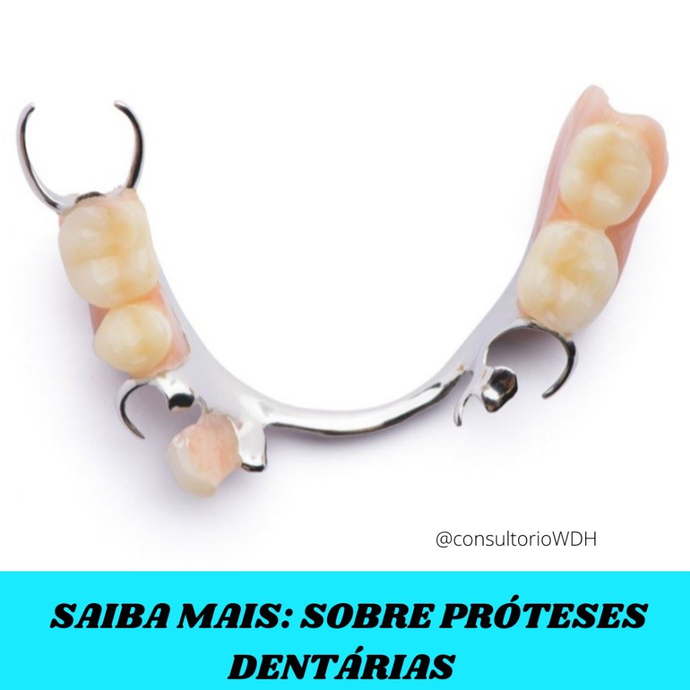 ⚠️ As próteses dentárias são estruturas que podem ser utilizadas com o objetivo de restaurar o sorriso por meio da substituição de um ou mais dentes que faltam na boca ou que estão desgastados. Assim, as próteses são indicadas pelo dentista com o objetivo de melhorar a mastigação e a fala da pessoa, que podem ser prejudicadas pela falta de dente. O tipo de prótese indicada pelo dentista depende da quantidade de dentes comprometidos ou em falta e da condição da gengiva. As próteses dentárias são indicadas pelo dentista de acordo com a quantidade de dentes comprometidos ou em falta, além da condição geral da boca do paciente. Assim, as próteses podem ser classificadas em parciais, quando apenas alguns dentes são substituídos na prótese, ou total, quando há necessidade de substituir todos os dentes, sendo esse último tipo de prótese mais conhecida como dentadura. 
📍R. Sete de Setembro, n 14 - Centro
📞 (35) 3292-4926 ou (35) 99732-4038