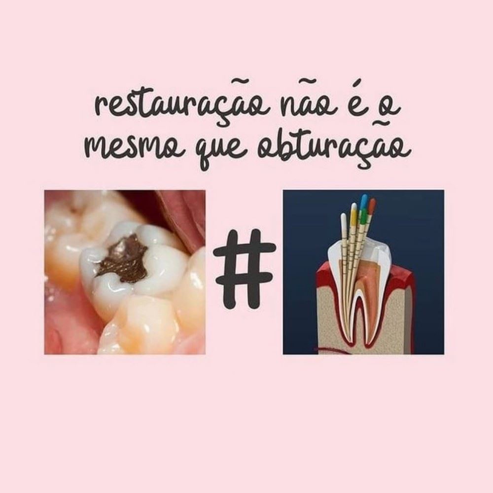 Você sabia? 🤔
A obturação consiste no selamento do canal radicular – a raiz do dente, situada dentro do osso. Então, a obturação nada mais é do que o vedamento dos canais radiculares com determinado material. Diferentemente da restauração, que trata o problema externamente. A restauração é um reparo realizado na coroa do dente, que é a parte exposta da cavidade oral, que fica acima do nível da gengiva.
Agende já a sua avaliação no nosso consultório! 💙
📍R. Sete de Setembro, n 14 - Centro
📞 (35) 3292-4926 ou (35) 99732-4038