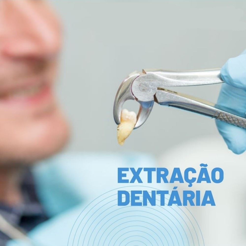 ❓ Os dentes são extraídos por vários motivos:
• Uma cárie muito profunda no dente;
• Uma infecção que destruiu uma grande porção do dente ou do osso adjacente;
• Não existe espaço suficiente para todos os dentes em sua boca.
Muitos dentistas recomendam a extração de dentes inclusos que nasceram apenas parcialmente. As bactérias podem se instalar em volta de um dente que nasceu parcialmente, causando uma infecção, a qual pode se estender para o osso adjacente e tornar-se um problema ainda mais sério. Remover um dente incluso pode evitar uma infecção, danos aos dentes e osso adjacentes, além de evitar um sofrimento futuro.
Agende já a sua avaliação conosco!
📍R. Sete de Setembro, n 14 - Centro 
📞 (35) 3292-4926 ou (35) 99732-4038