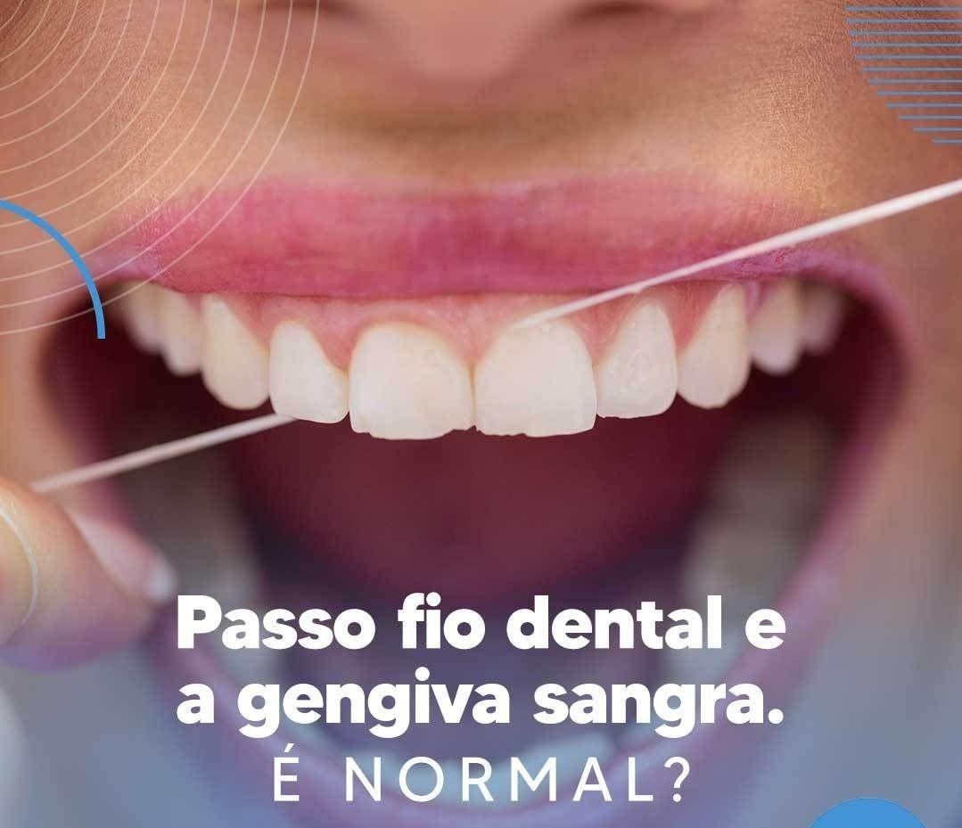 Você sabia? ⚠️
Essa situação ocorre somente quando a gengiva não está perfeitamente saudável. Dessa forma, ao usar o fio dental, a região que está sensível manifesta sintomas. O principal deles é o sangramento.
Um dos principais problemas da gengiva sangrar ao usar fio dental é a gengivite. Trata-se de uma inflamação que atinge as camadas mais externas e superficiais da gengiva.
Agende já a sua avaliação no nosso consultório! 💙
Segunda a sexta: 08h as 18h
Aos sábados: 08h as 12h
📍R. Sete de Setembro, n 14 - Centro 
📞 (35) 3292-4926 ou (35) 99732-4038