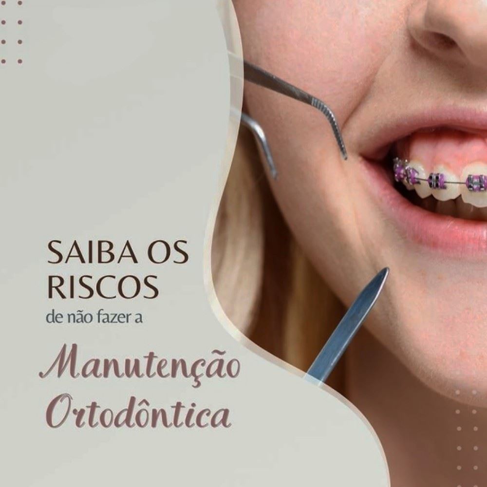 São alguns deles: 
1) Atrasar o tratamento - Em primeiro lugar não fazer a manutenção indicada por seu ortodontista pode atrasar o seu tratamento, ou seja, prolongar o tratamento e permanecer por mais tempo com o aparelho. 
2) Afeta a higiene bucal - Mesmo se o paciente faz a escovação adequada e utiliza o fio dental, ainda sim pode haver restos de alimentos entes os aparelhos e durante a manutenção o dentista realiza a higienização completa.
3) O aparelho perde a sua função - A consulta de manutenção de aparelho ortodôntico é realizada também para que ele seja ajustado. O ortodontista adapta o aparelho mais uma vez a fim de que ele volte a exercer força sobre os dentes e estimule-os a se reposicionarem.
Agende já a sua avaliação clínica e ortodôntica conosco! 😉
Segunda a sexta: 08h as 18h
Aos sábados: 08h as 12h
📍R. Sete de Setembro,  n 14 - Centro 
📞 (35) 3292-4926 ou (35) 99732-4038