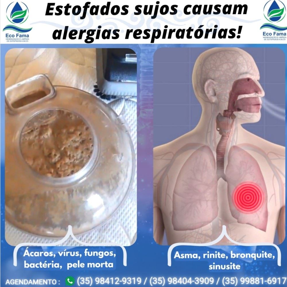 ECO FAMA HIGIENIZAÇÃO E LIMPEZA DE ESTOFADOS A SECO 

Estofados sujos podem causar doenças respiratórias e cutâneas. 

Os estofados são responsáveis por 90% das nossas alergias respiratórias e cutâneas, por isso é fundamental manter eles sempre adequadamente higienizados e limpos. 

A ECO FAMA elimina todos os tipos de germes e microorganismos dos estofados até 30cm de profundidade. 

Contrate agora mesmo os nossos serviços: (35) 98412-9319 / (35) 98404-3909 / (35) 9881-6917 

ATENDIMENTO EM ALFENAS E REGIÃO,  SEM TAXAS DE DESLOCAMENTO.