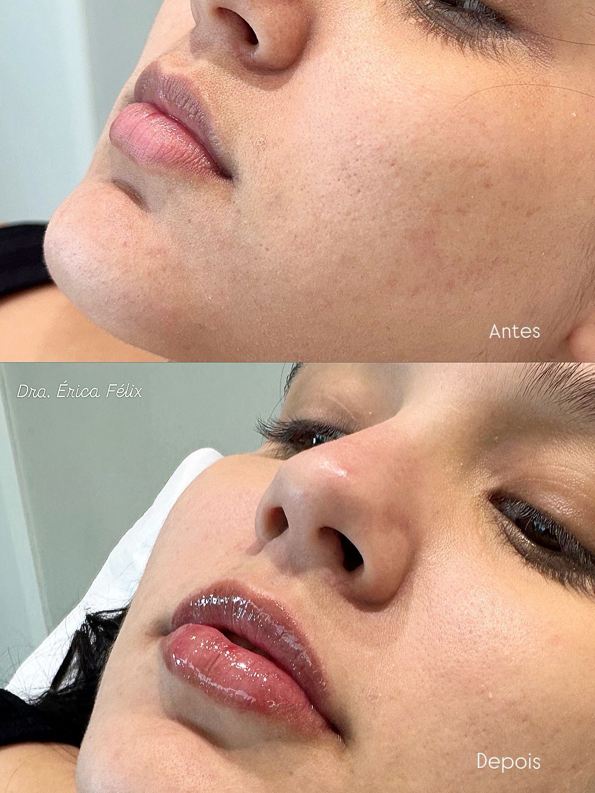 Érica Félix Harmonização Facial e Corporal - Estética Avançada