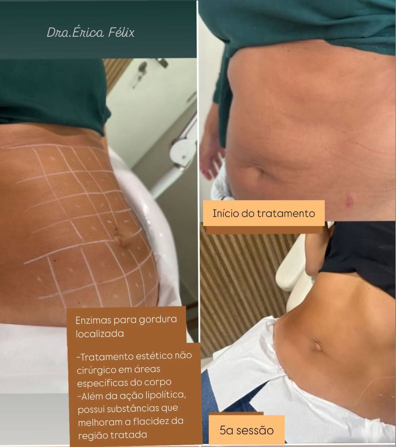 Érica Félix Harmonização Facial e Corporal - Estética Avançada