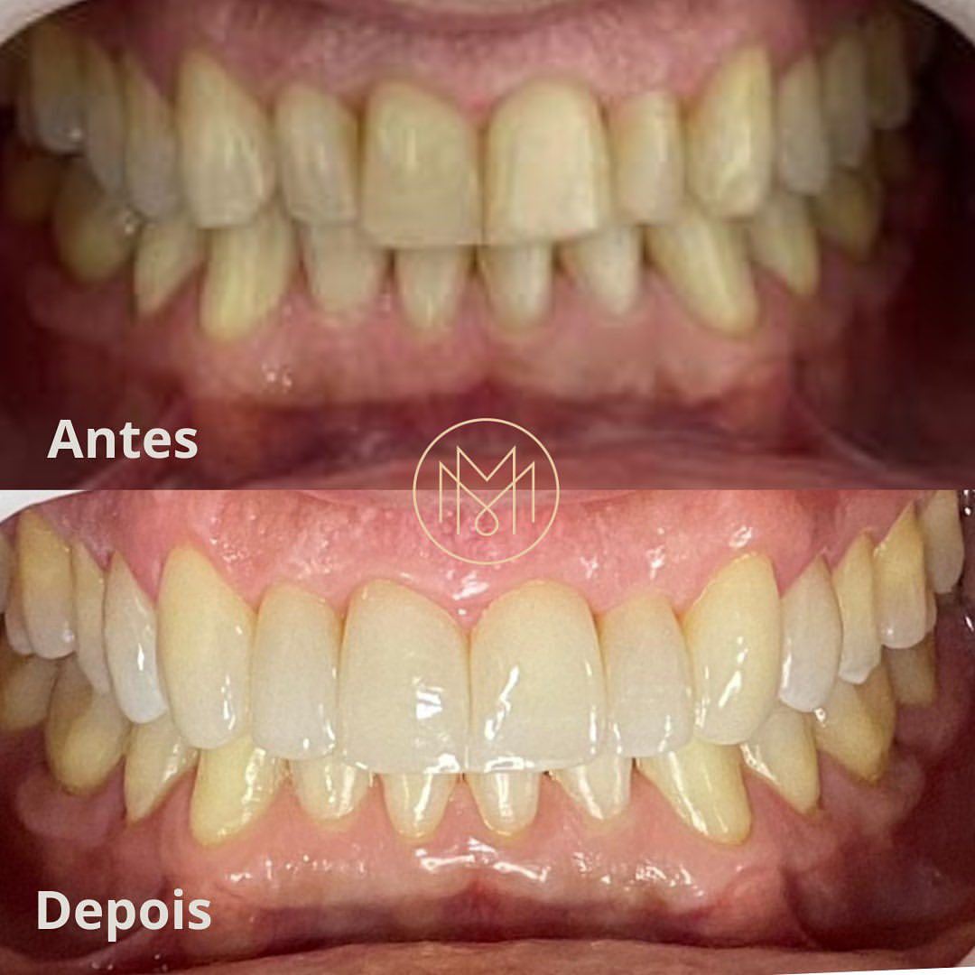 Martelli Odontologia