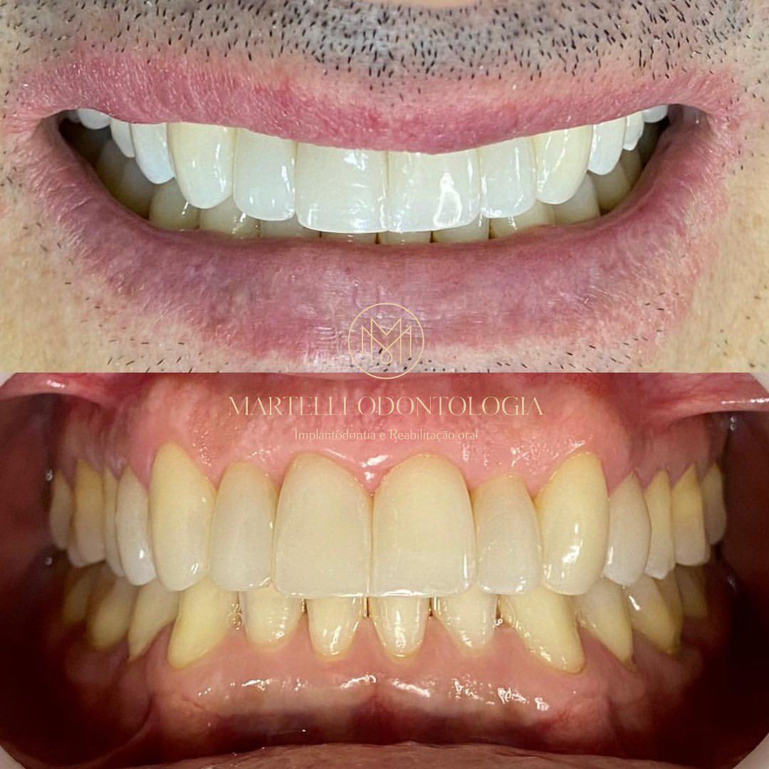 Martelli Odontologia