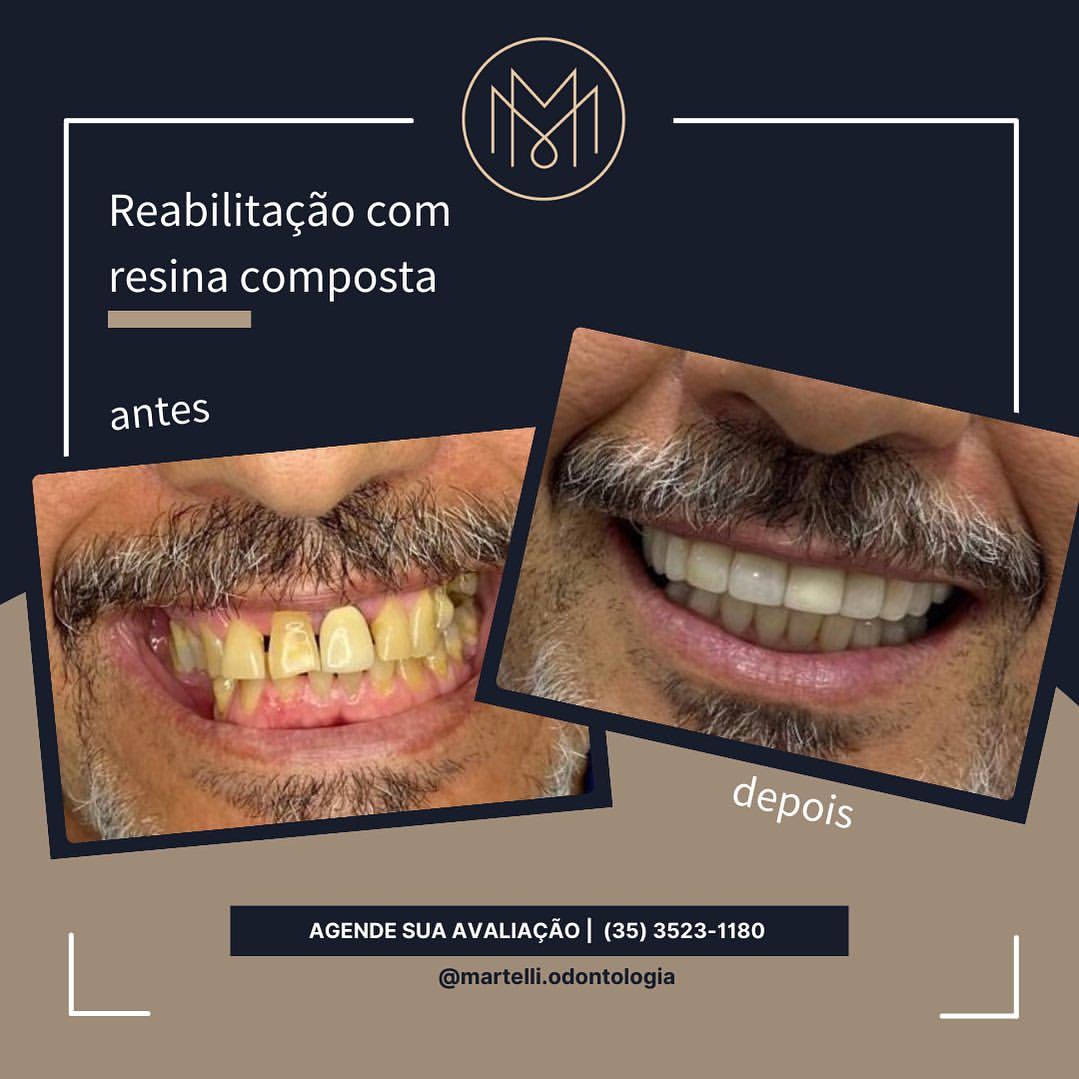 Martelli Odontologia