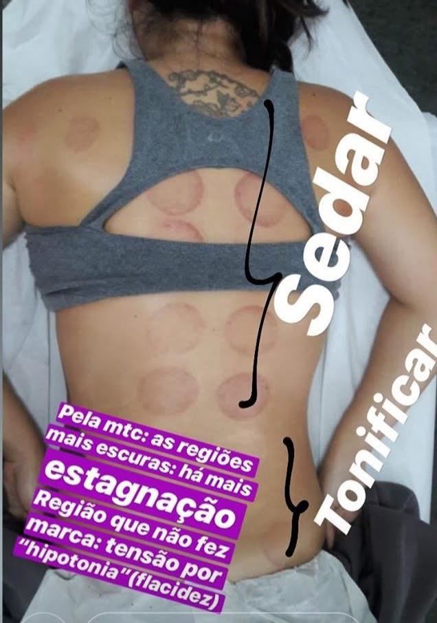 Massoterapia Lais