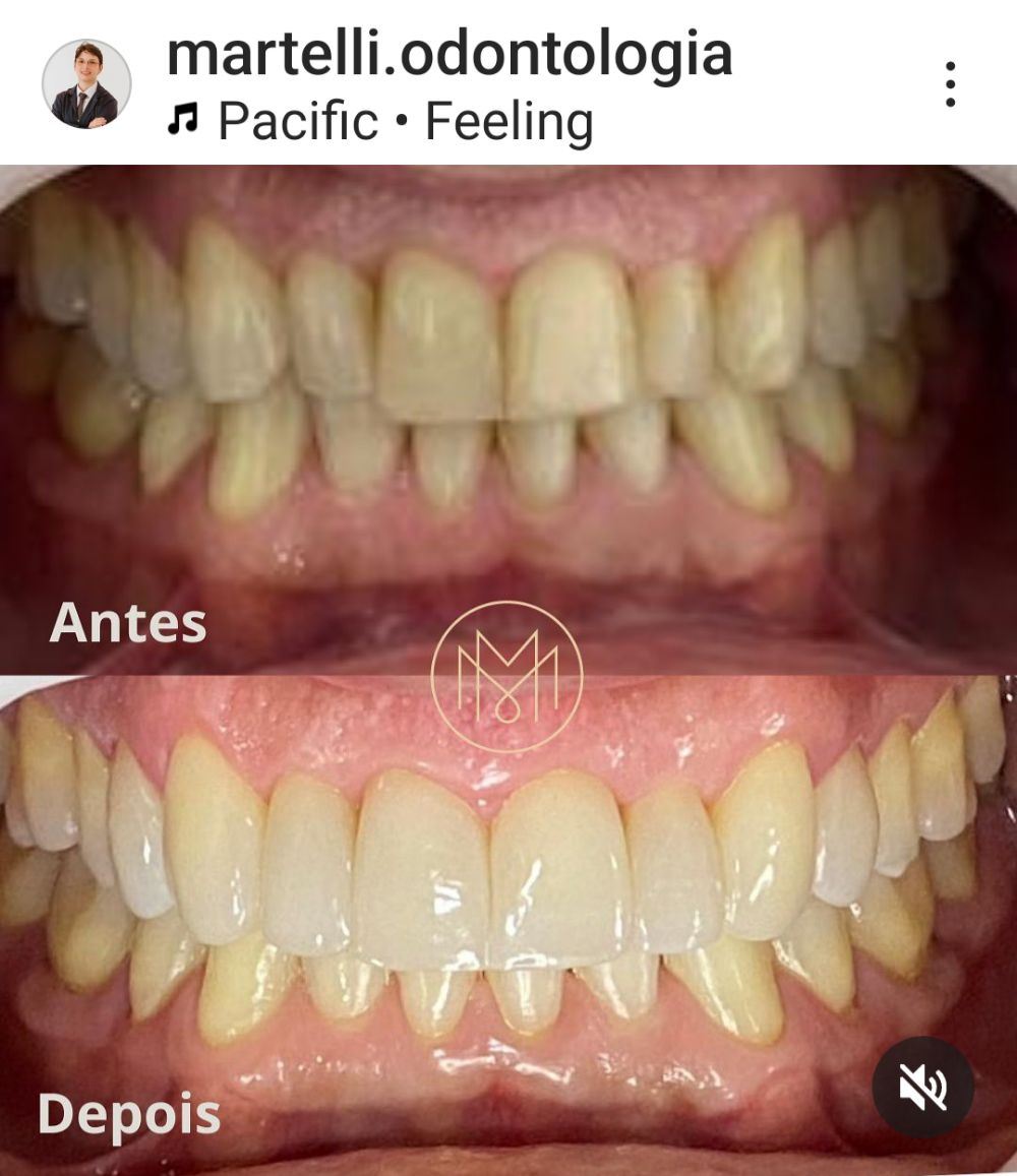 Consultório Odontológico Dr. Edson Martelli