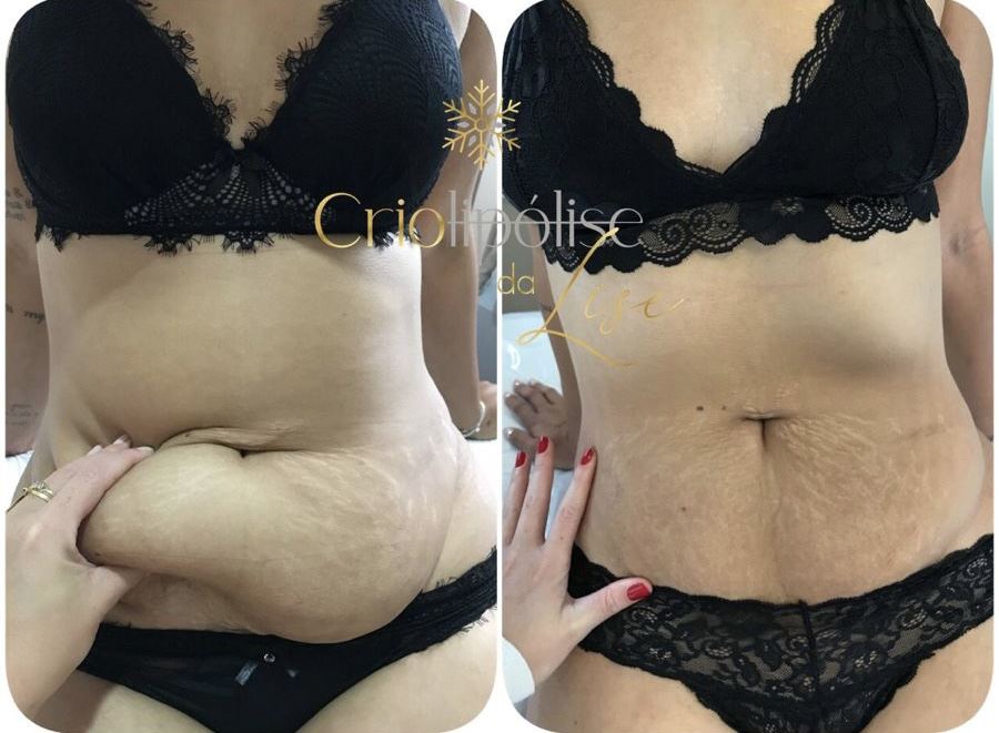 Tailise Nogueira Estética