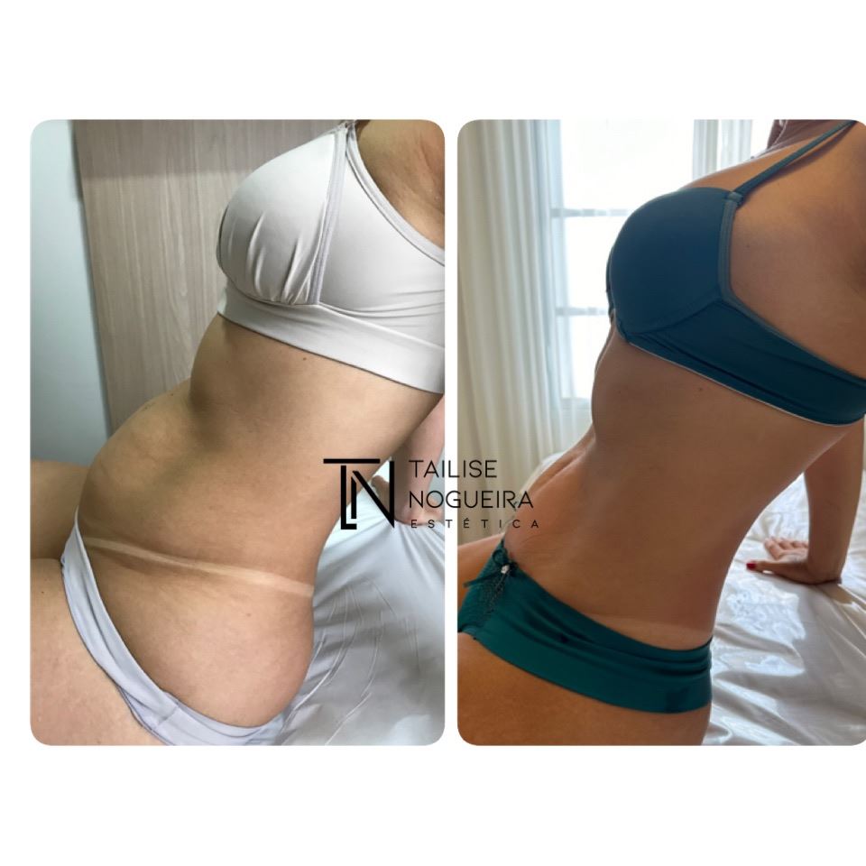 Tailise Nogueira Estética