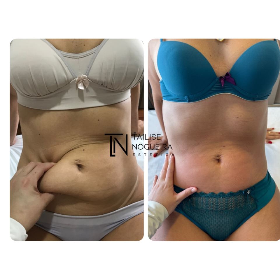 Tailise Nogueira Estética