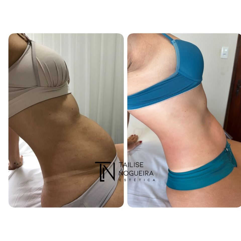 Tailise Nogueira Estética