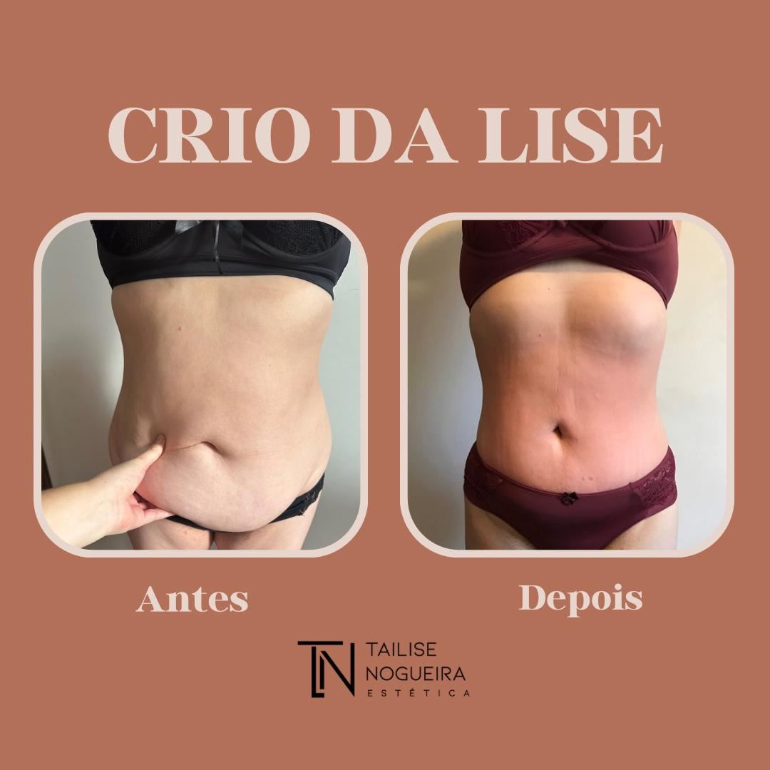 Tailise Nogueira Estética